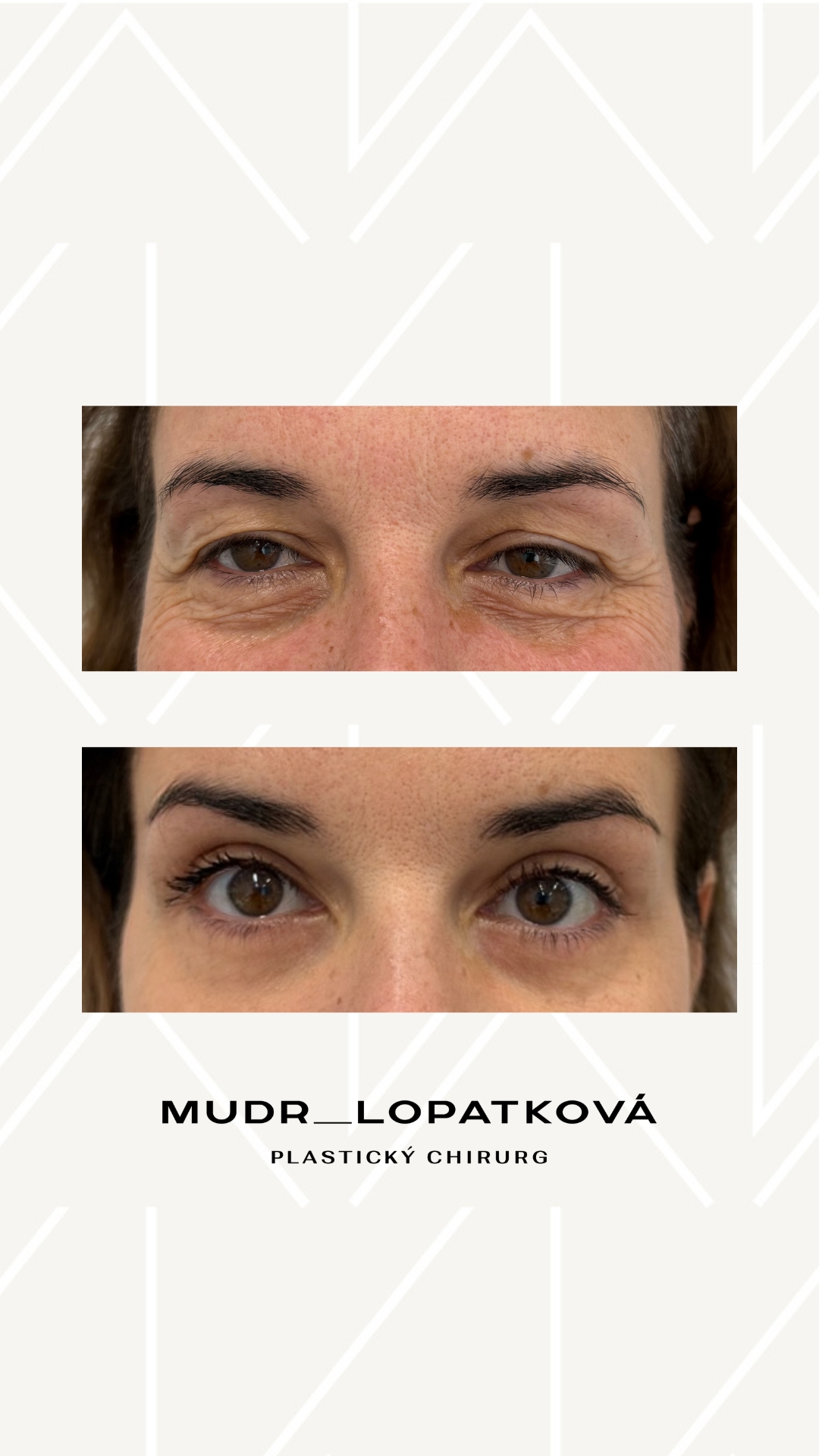 mudrlopatkova - ilustračná fotka časti tela