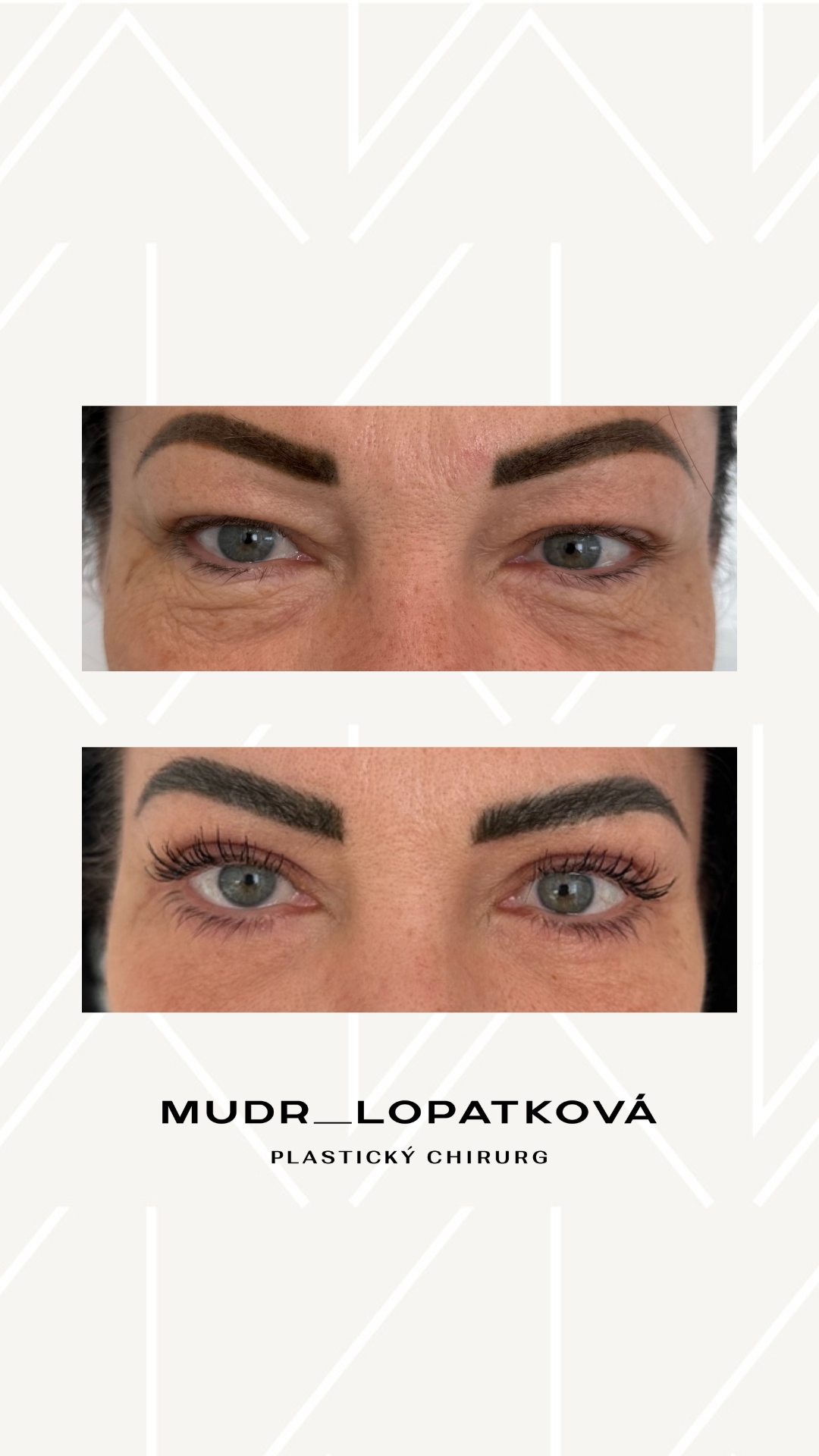 mudrlopatkova - ilustračná fotka časti tela