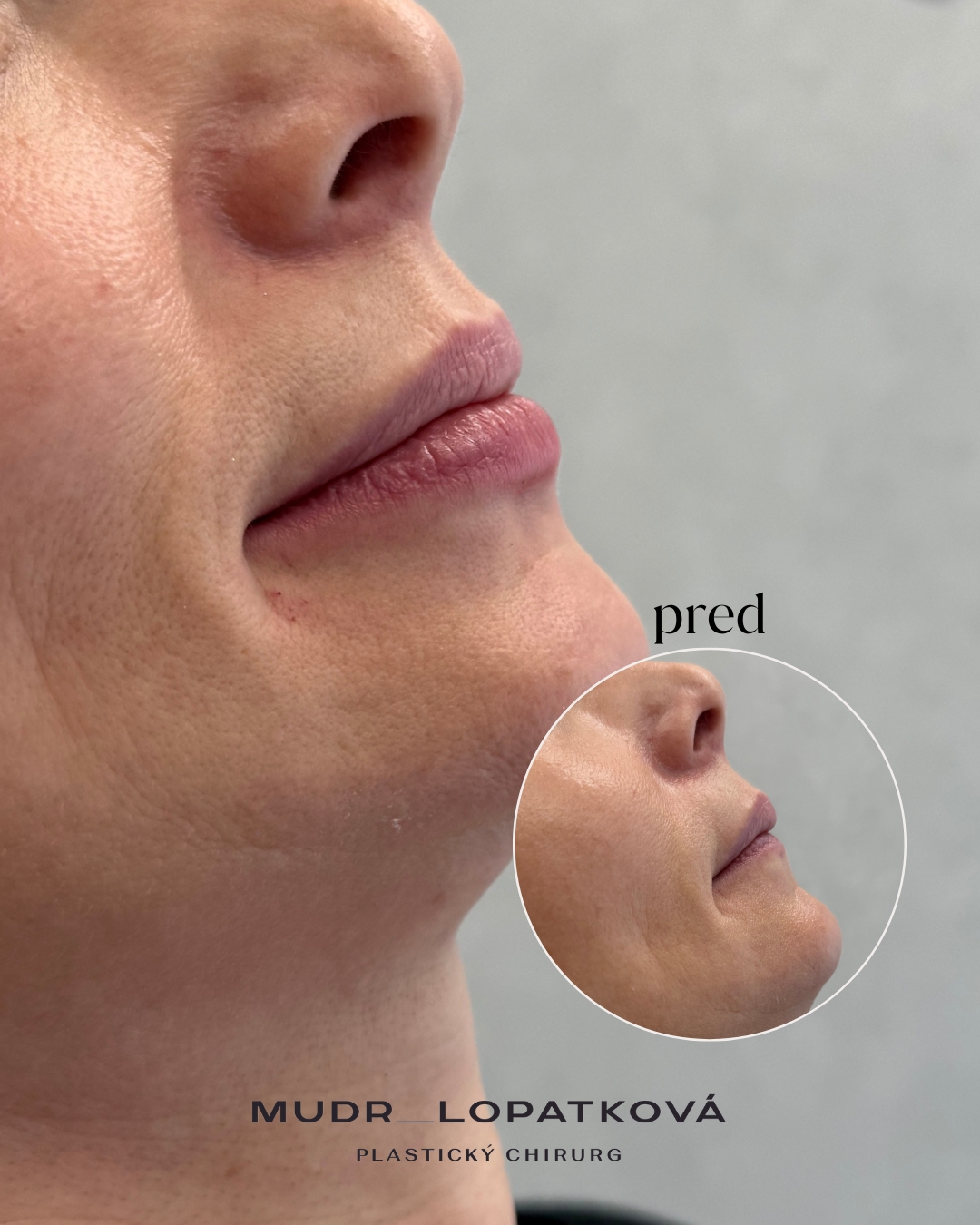 mudrlopatkova - ilustračná fotka časti tela