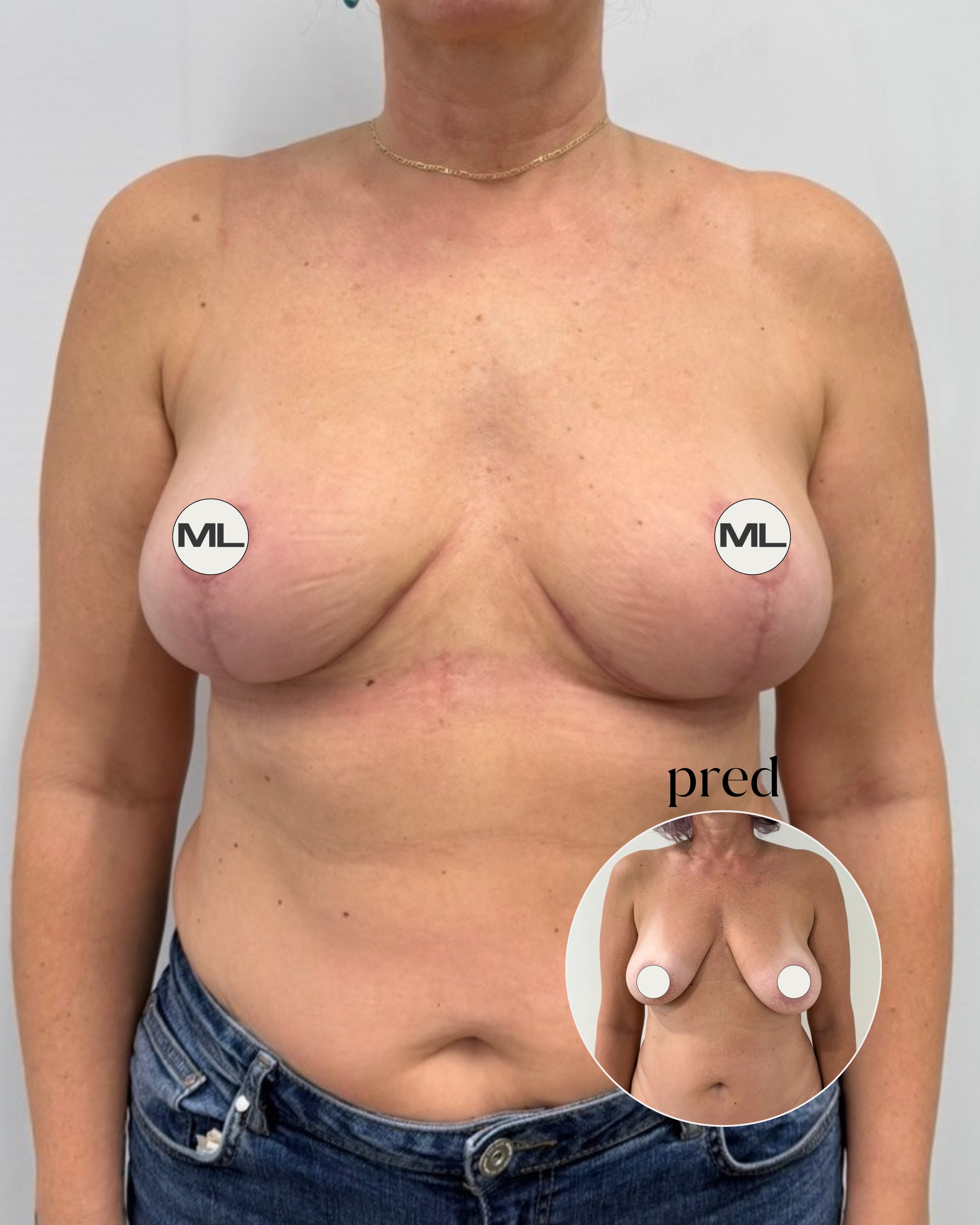 mudrlopatkova - ilustračná fotka časti tela