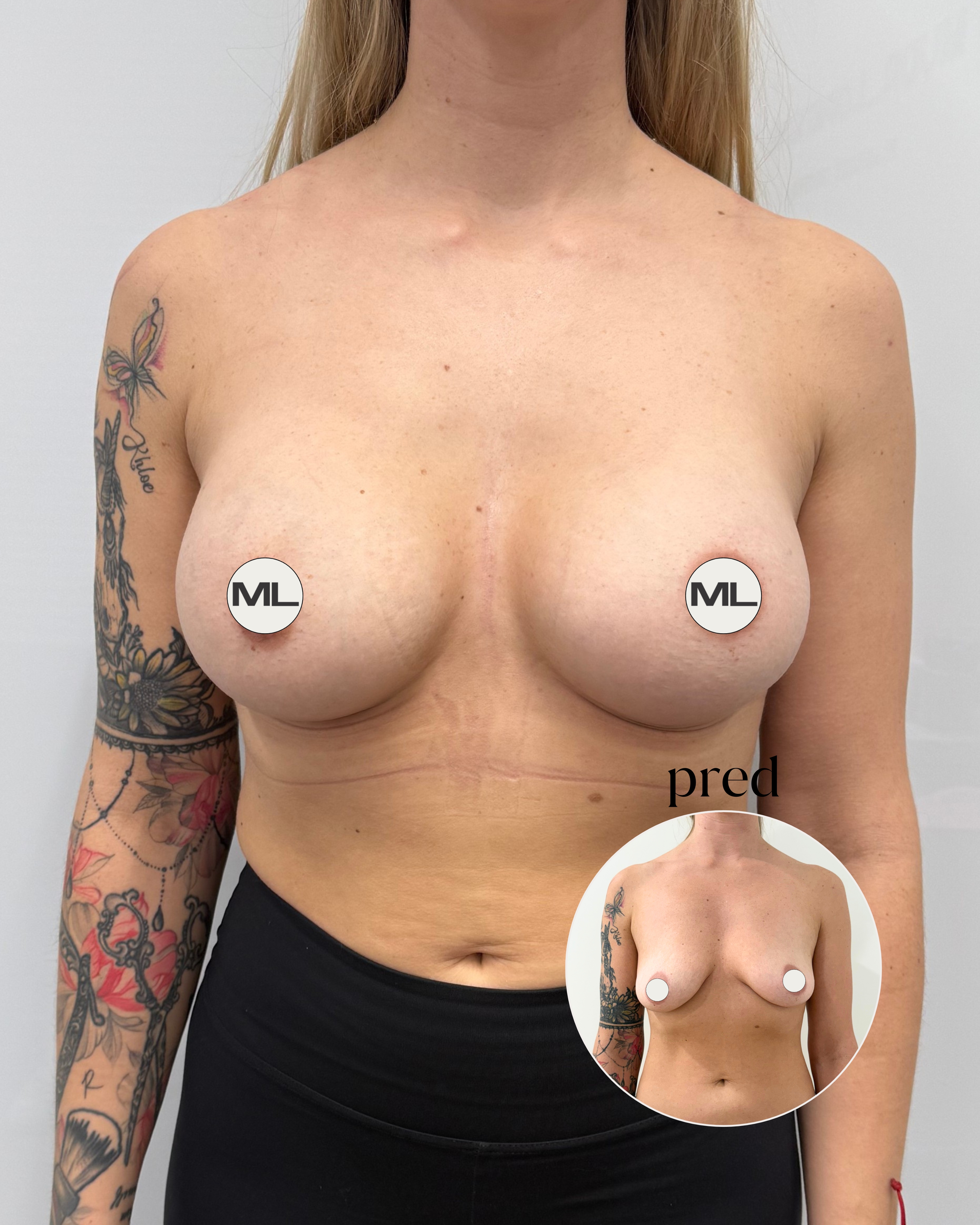 mudrlopatkova - ilustračná fotka časti tela