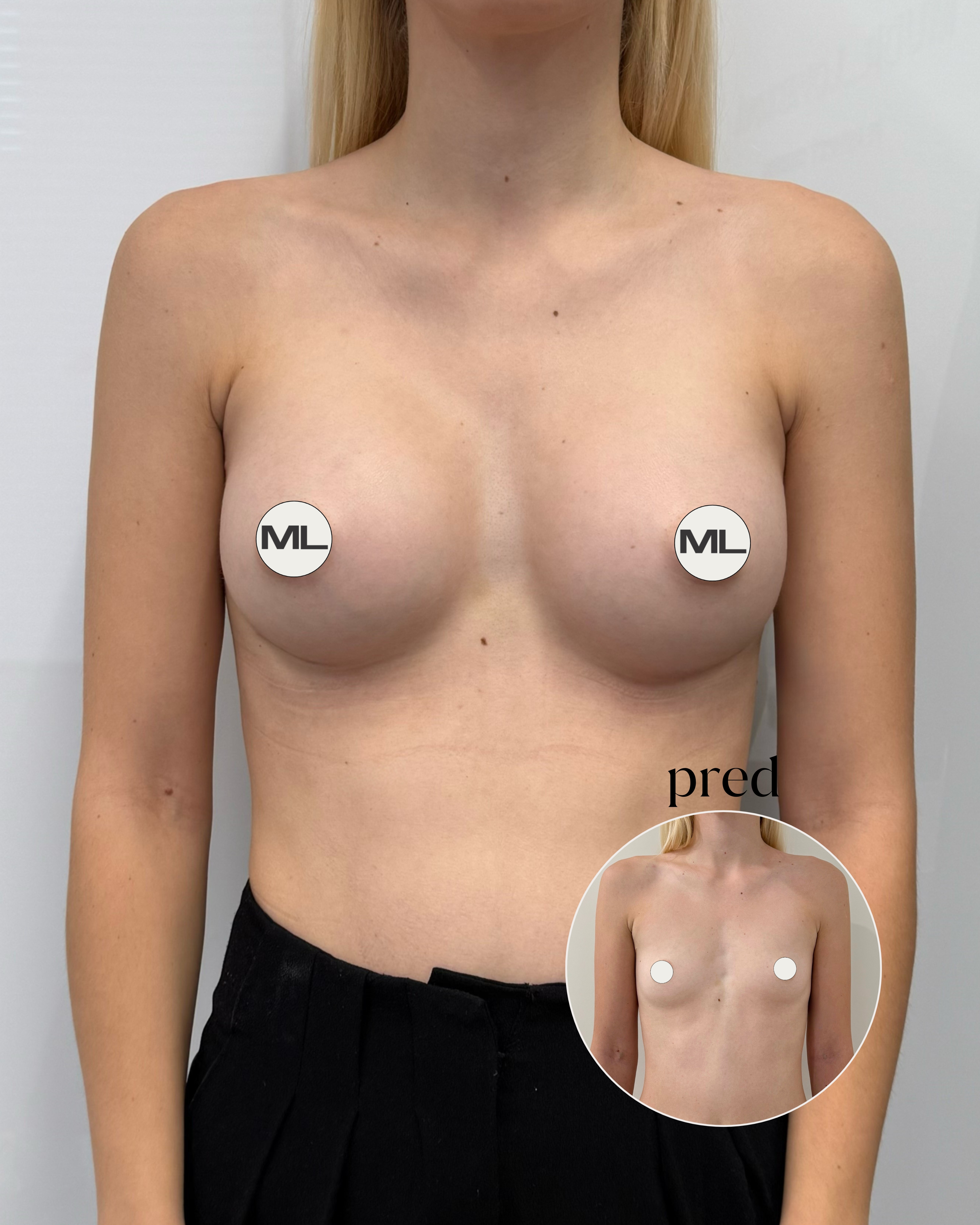 mudrlopatkova - ilustračná fotka časti tela