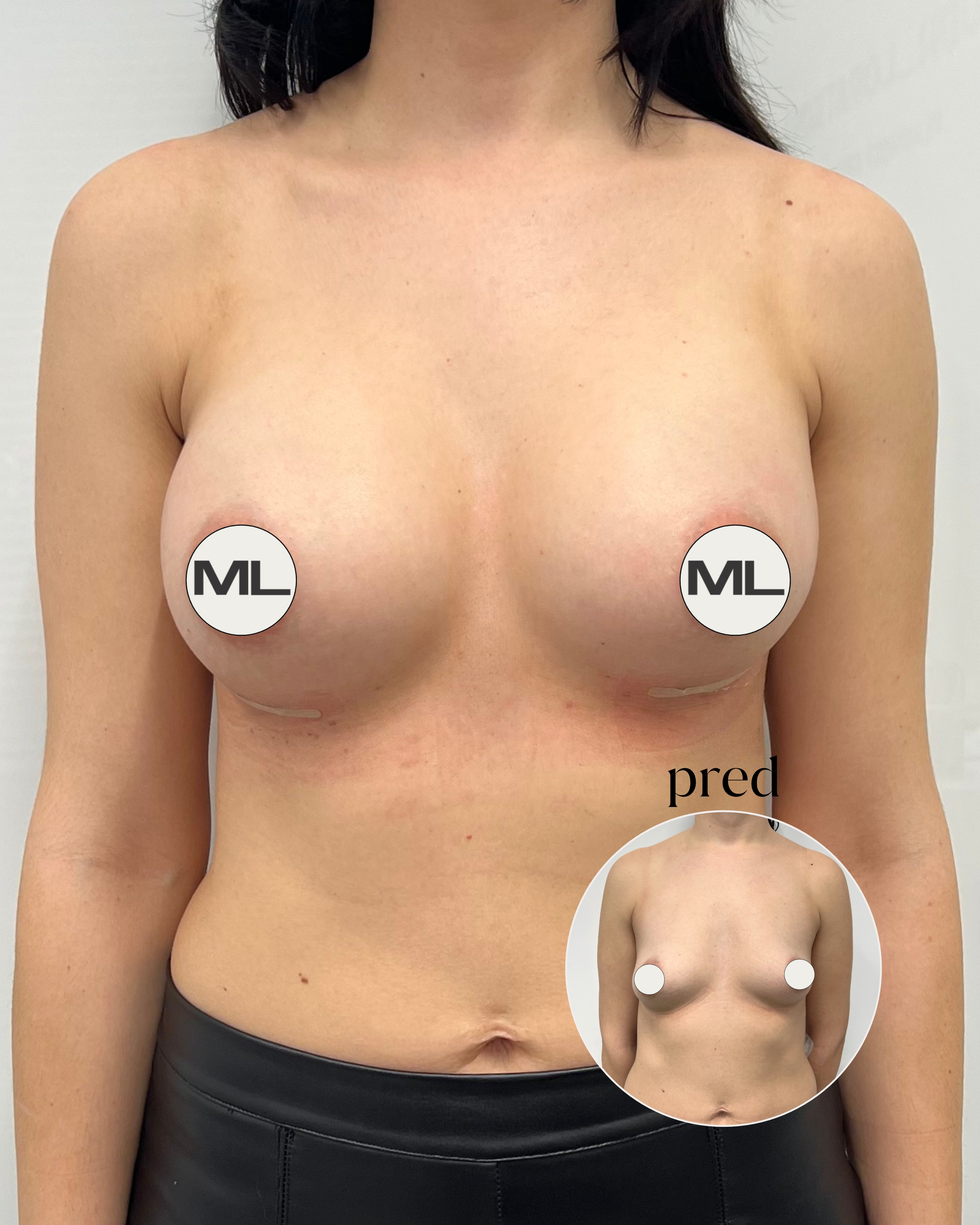 mudrlopatkova - ilustračná fotka časti tela