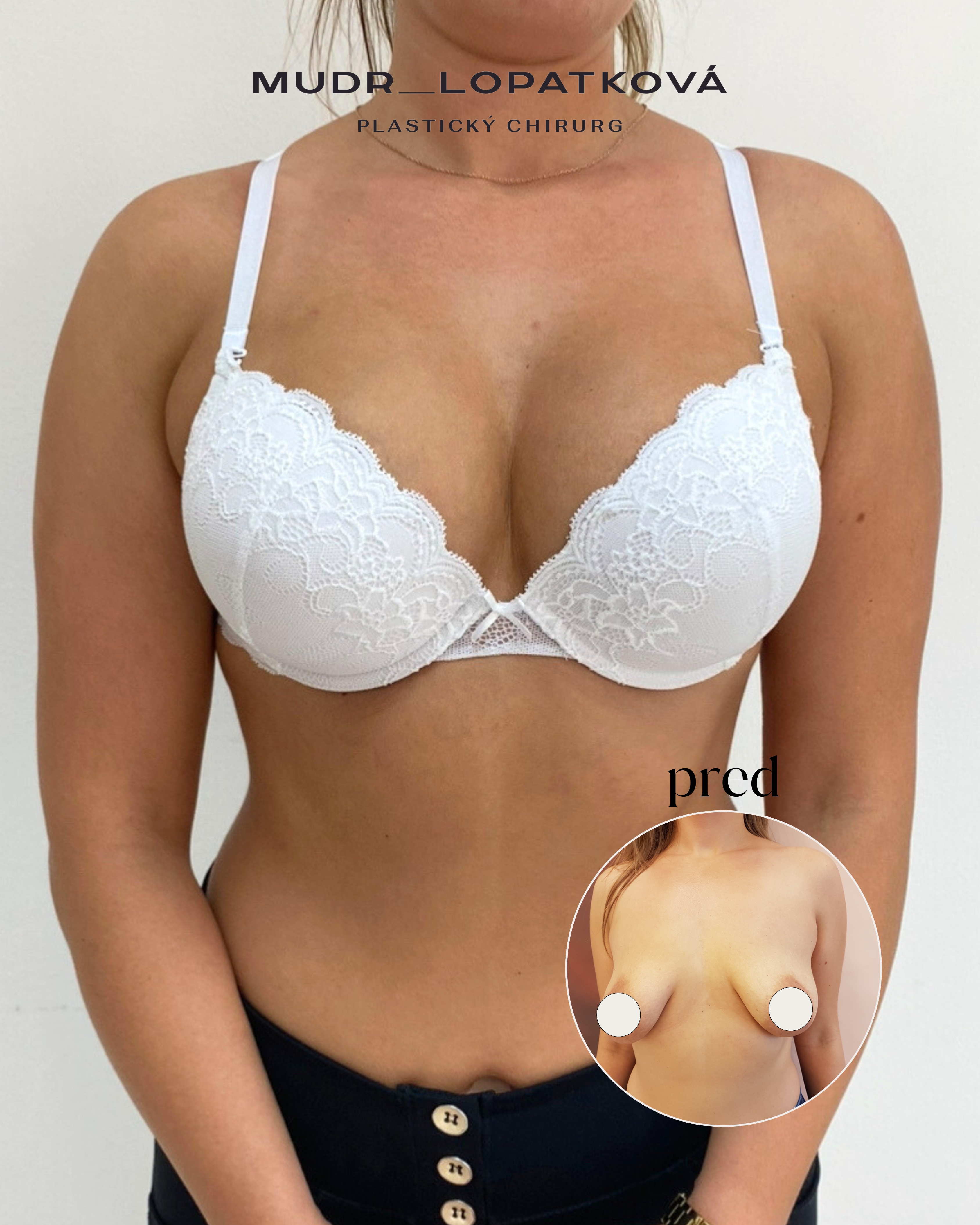 mudrlopatkova - ilustračná fotka časti tela