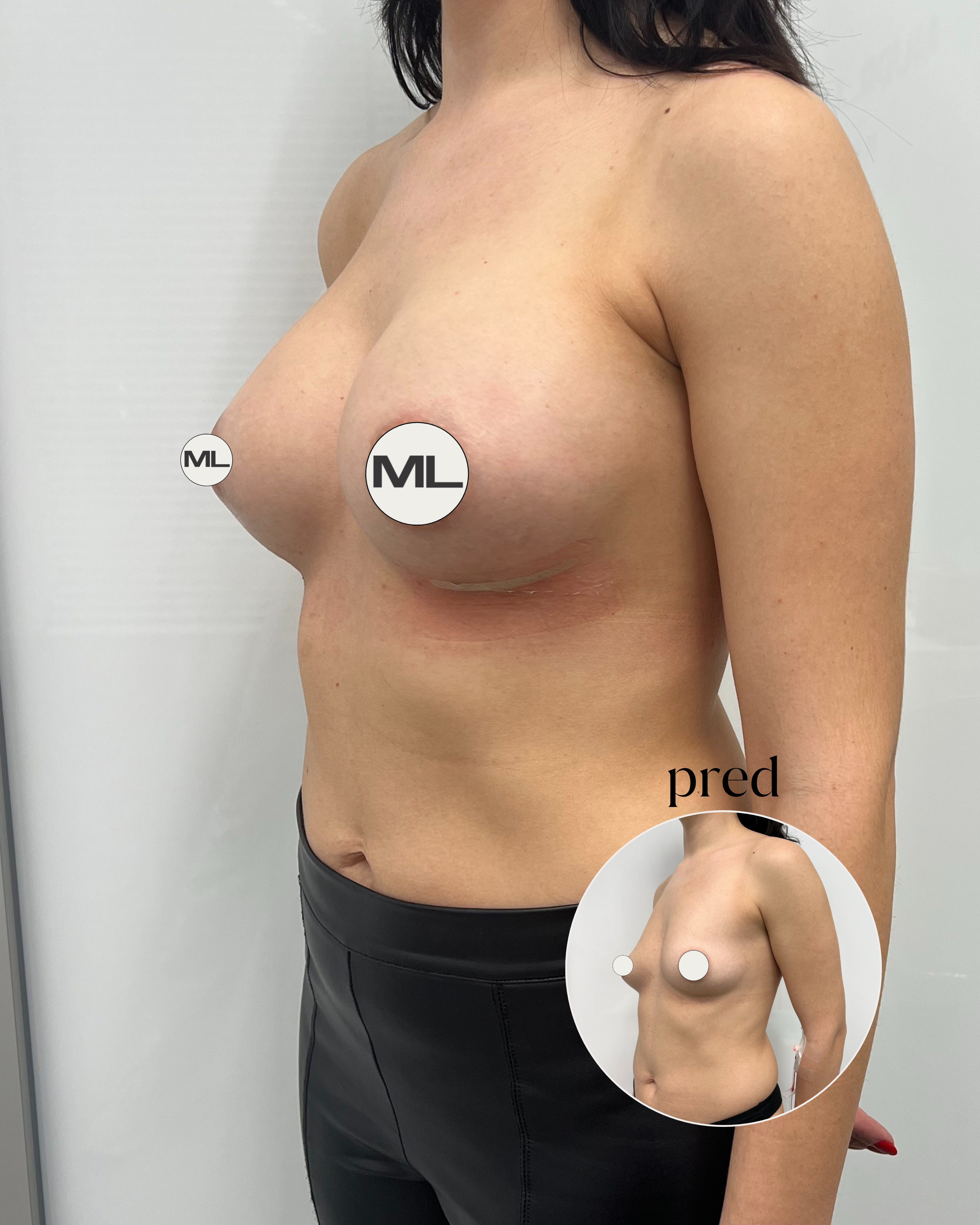 mudrlopatkova - ilustračná fotka časti tela