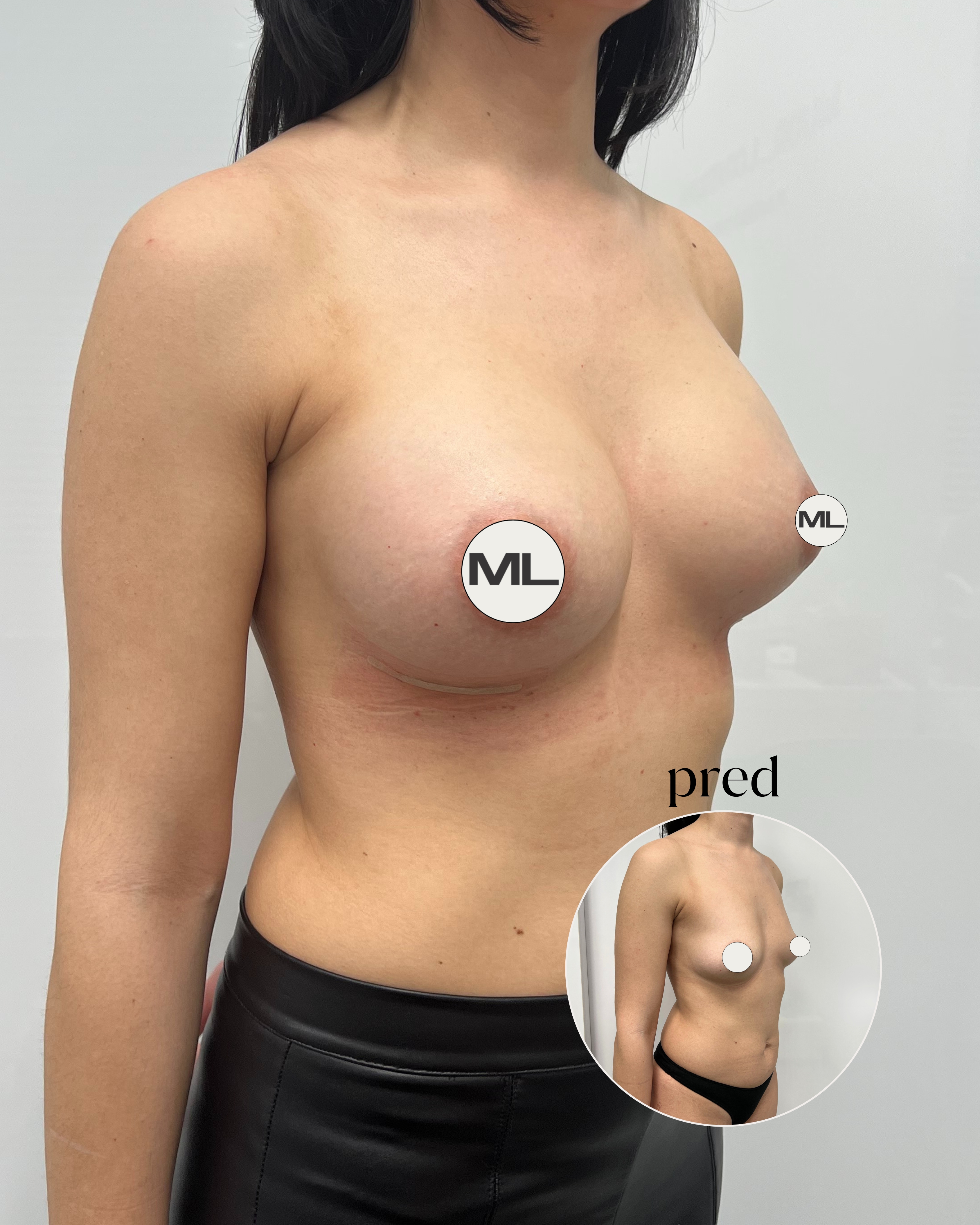 mudrlopatkova - ilustračná fotka časti tela