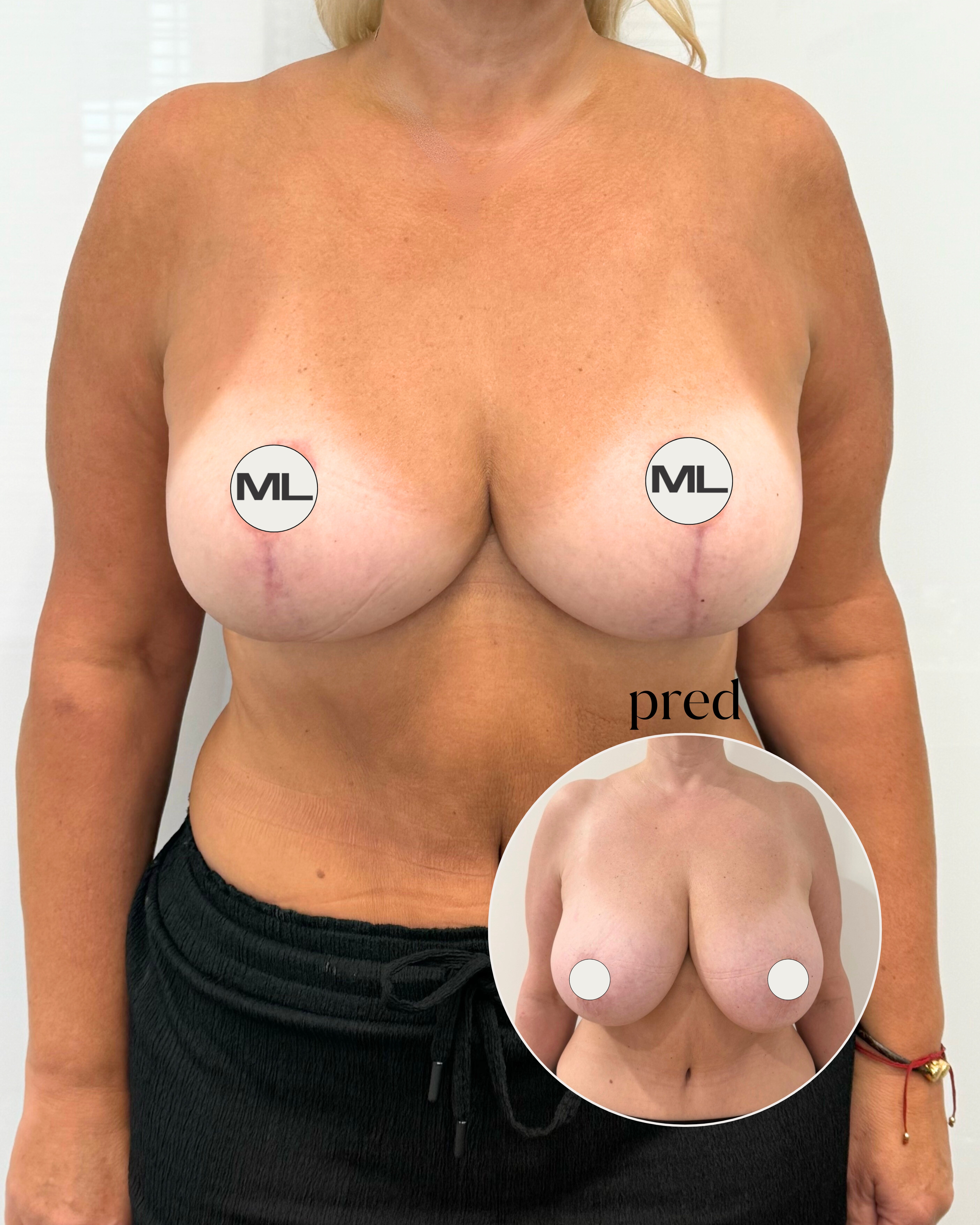 mudrlopatkova - ilustračná fotka časti tela