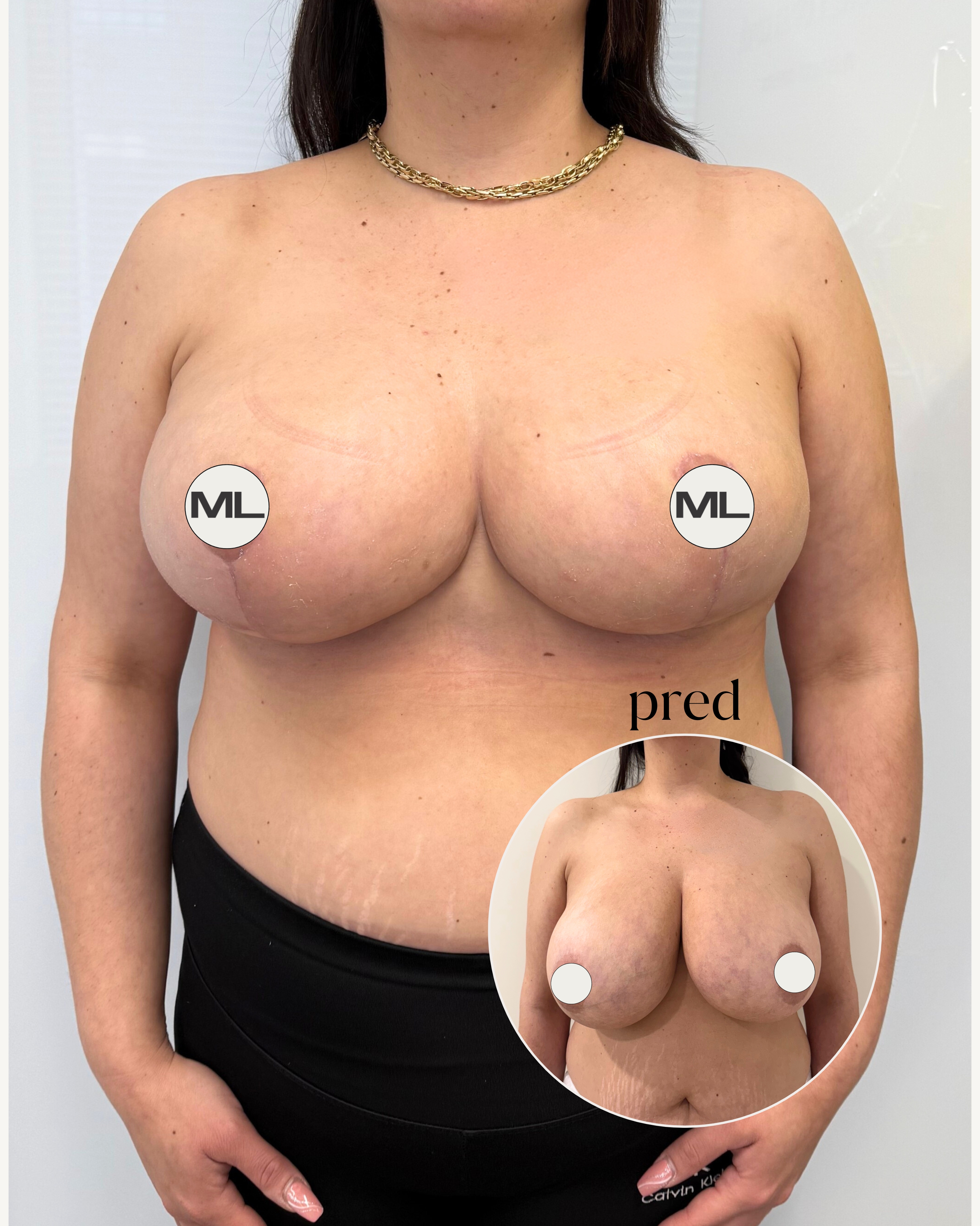 mudrlopatkova - ilustračná fotka časti tela