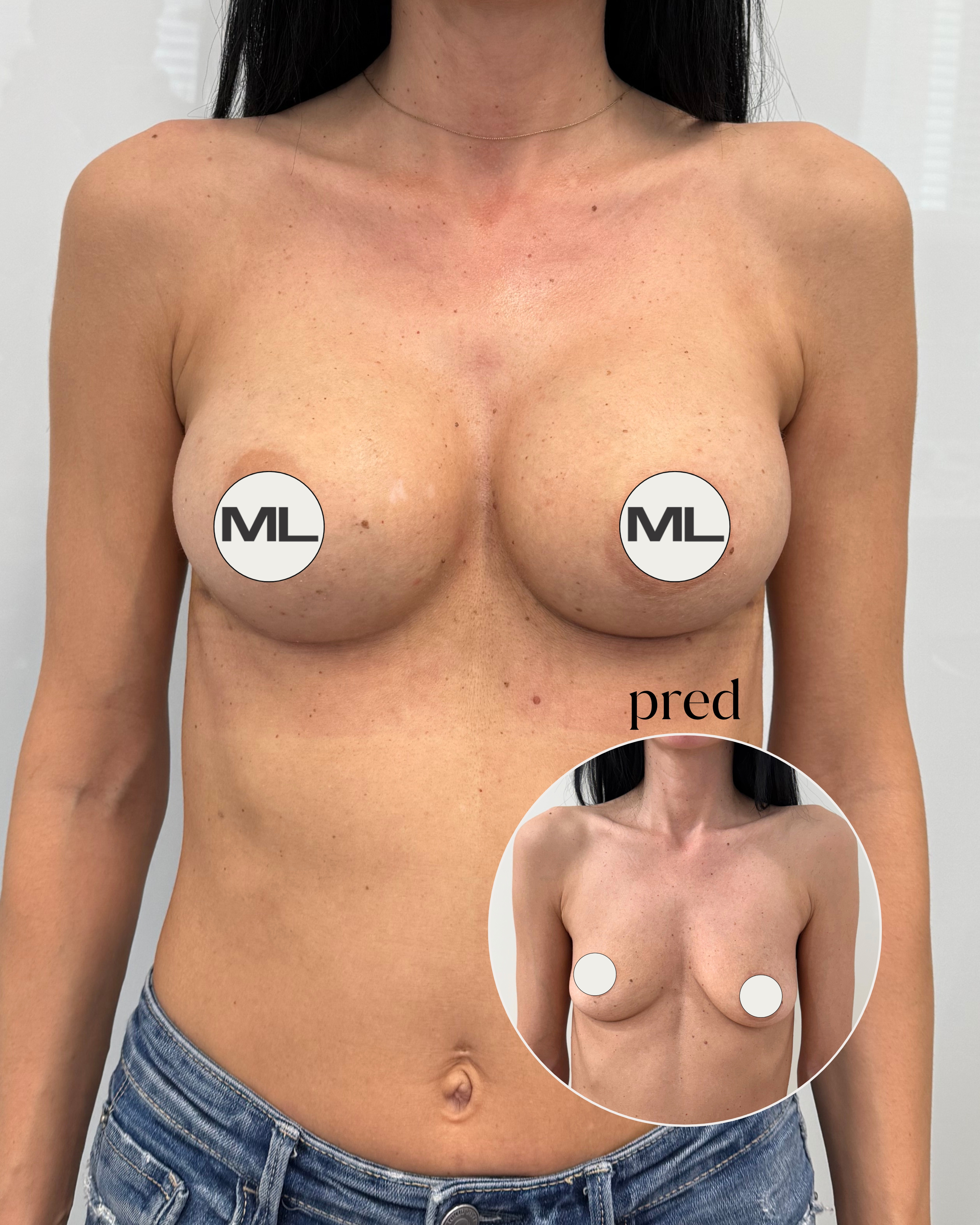 mudrlopatkova - ilustračná fotka časti tela