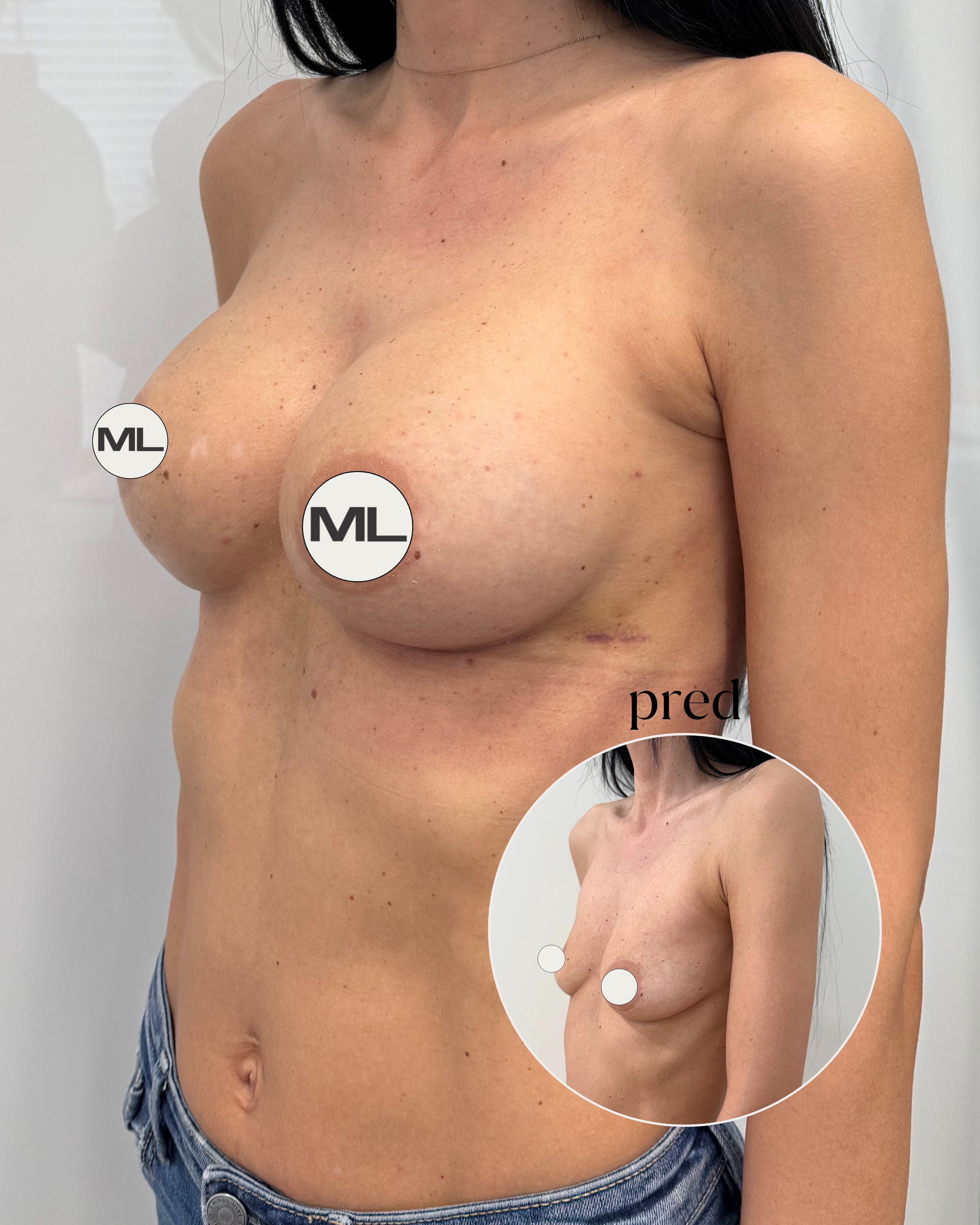 mudrlopatkova - ilustračná fotka časti tela