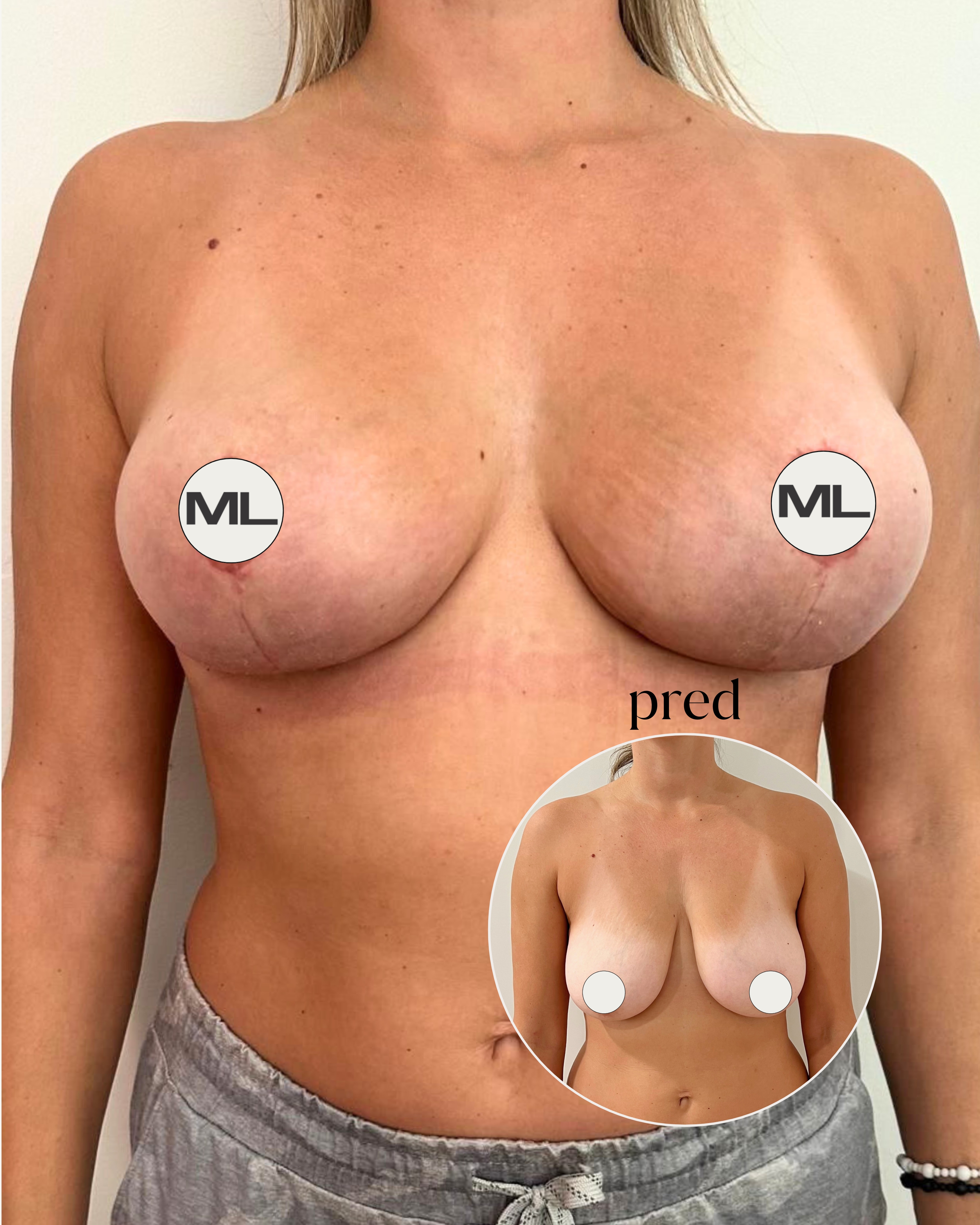 mudrlopatkova - ilustračná fotka časti tela