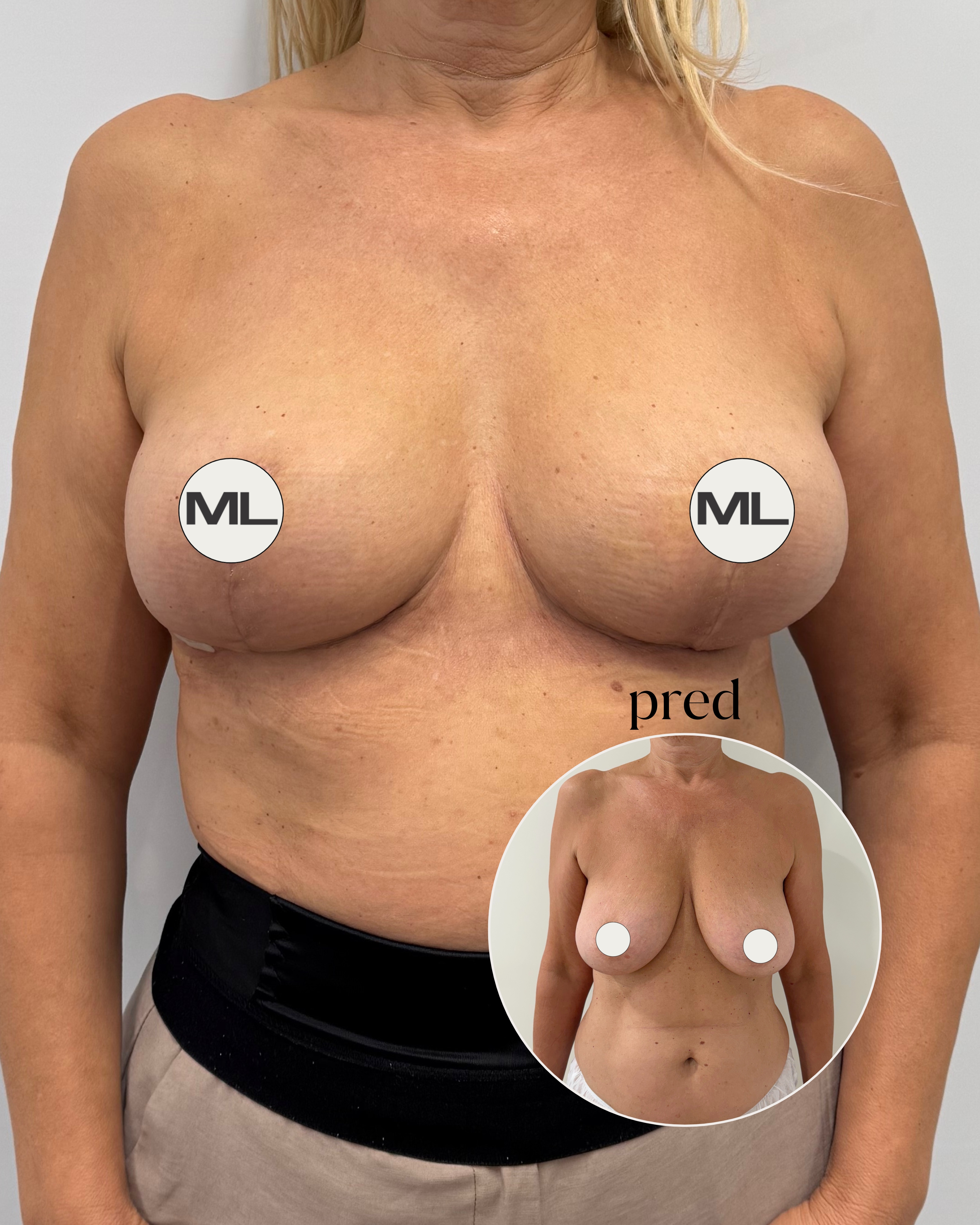 mudrlopatkova - ilustračná fotka časti tela