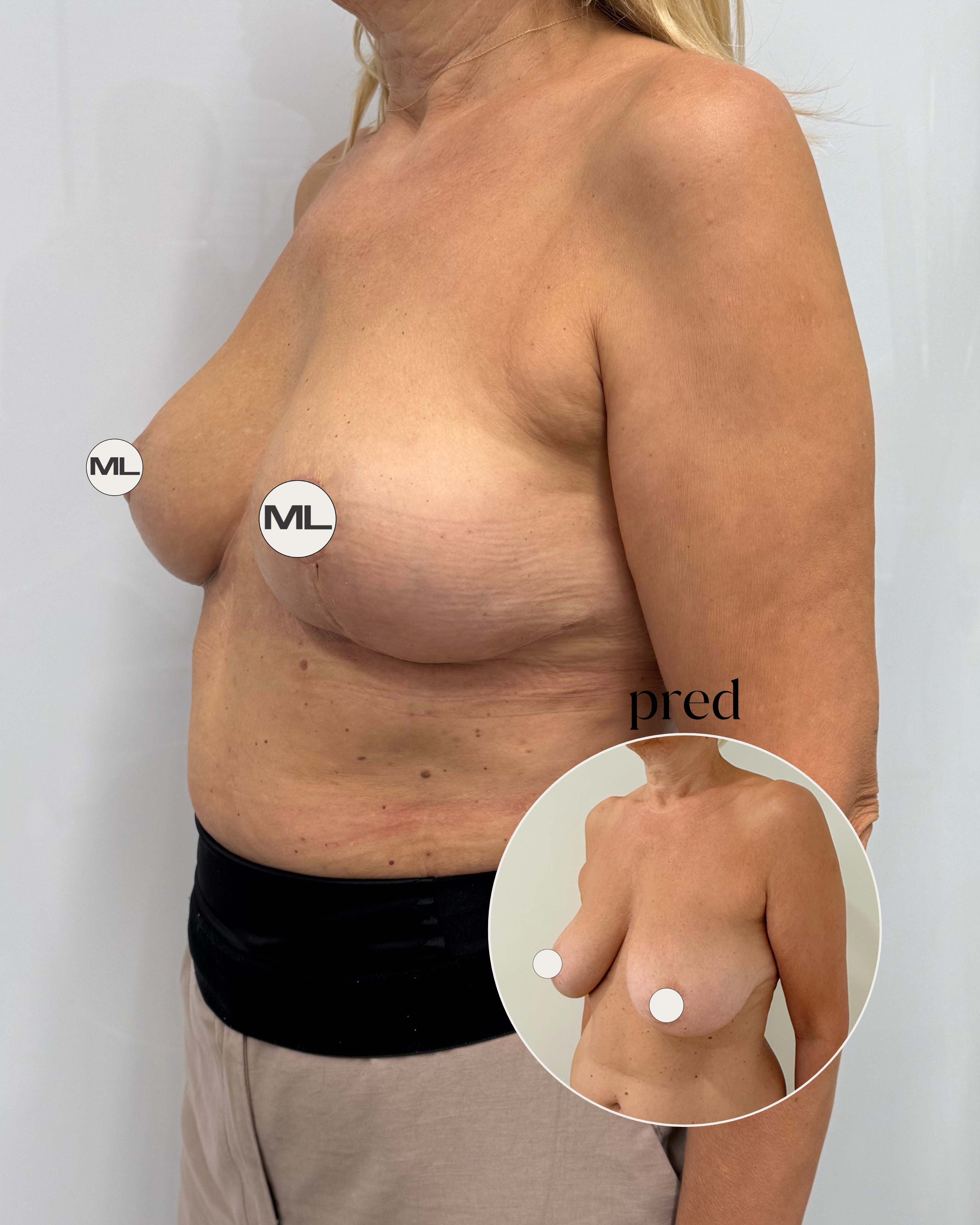 mudrlopatkova - ilustračná fotka časti tela