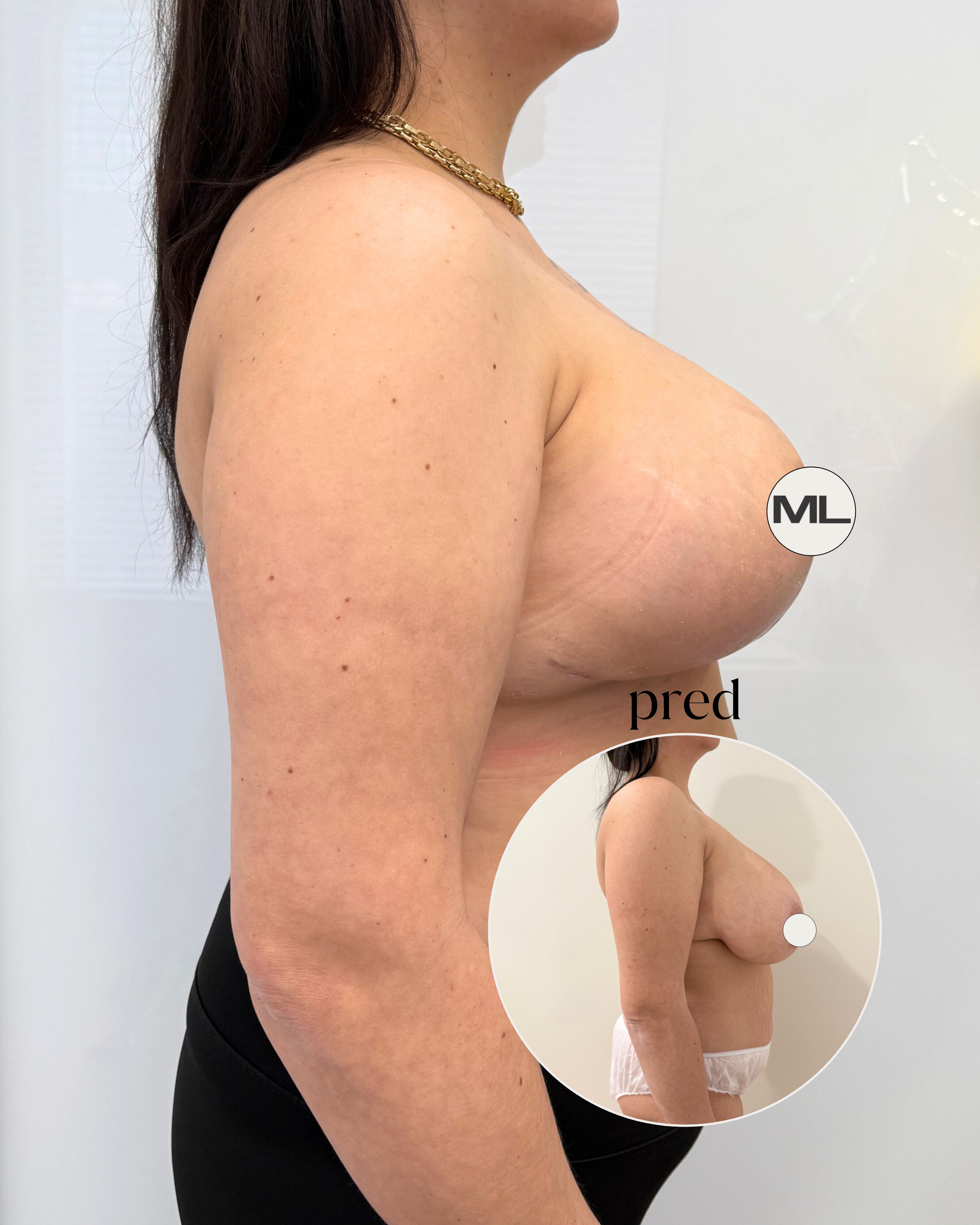 mudrlopatkova - ilustračná fotka časti tela