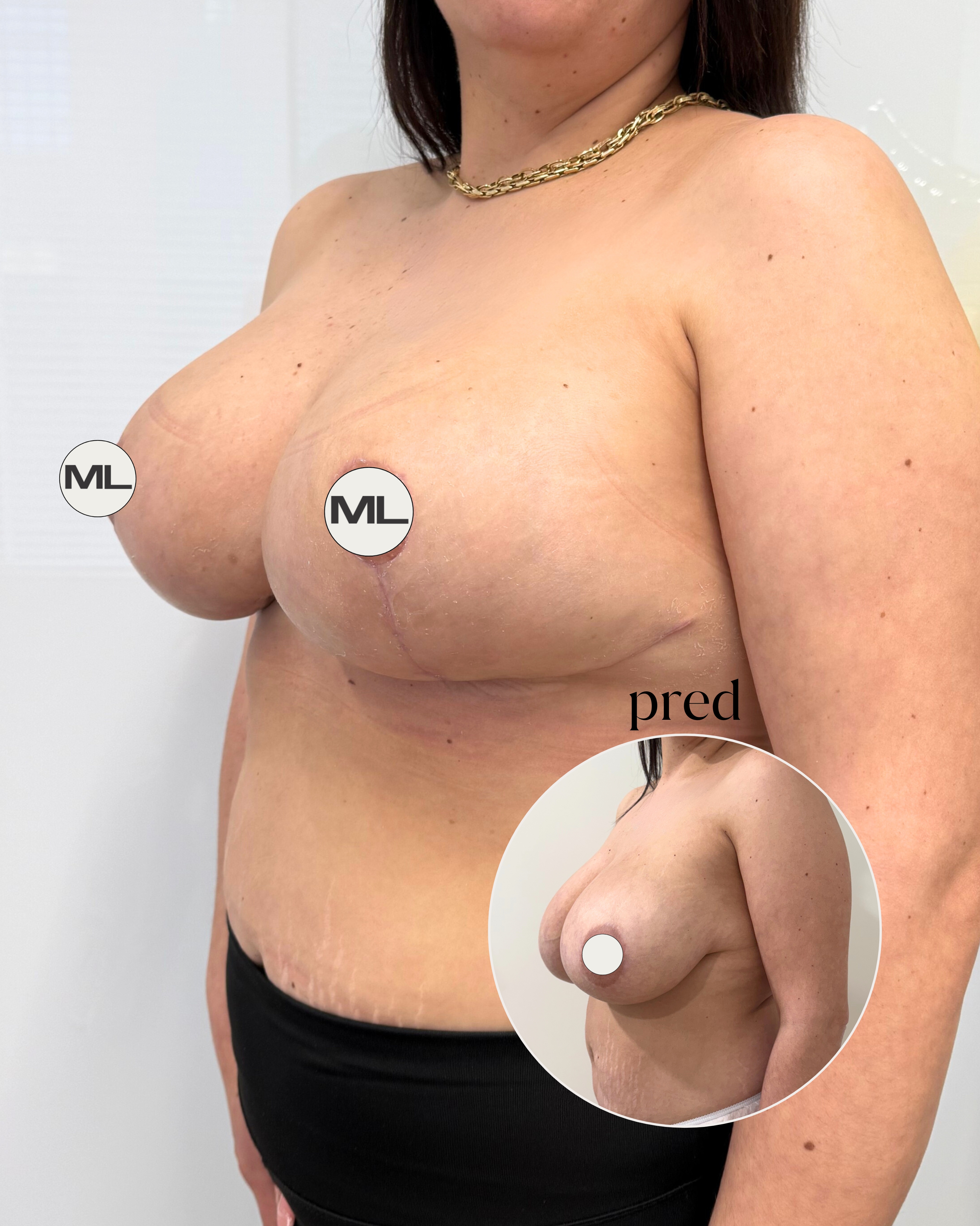 mudrlopatkova - ilustračná fotka časti tela