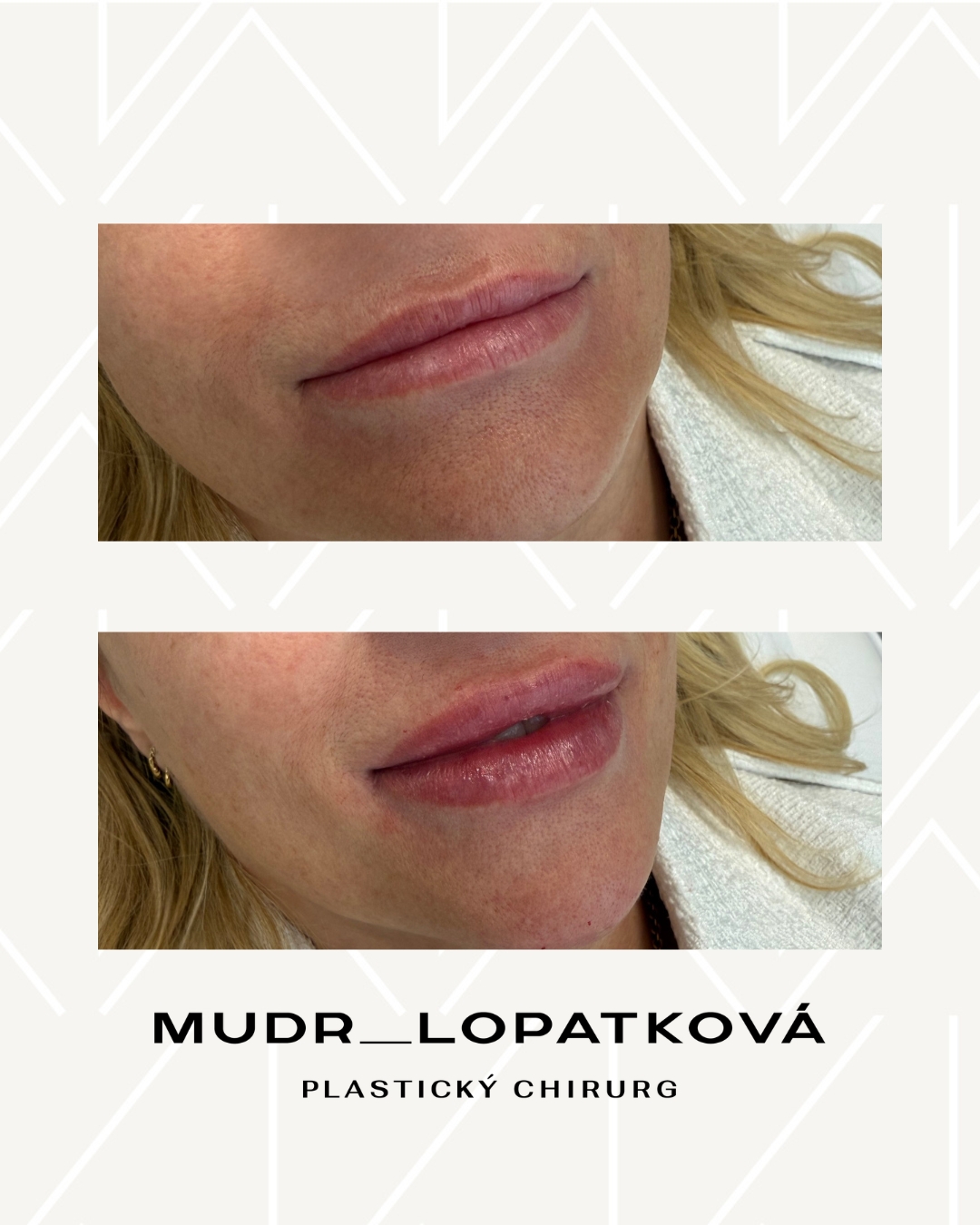 mudrlopatkova - ilustračná fotka časti tela