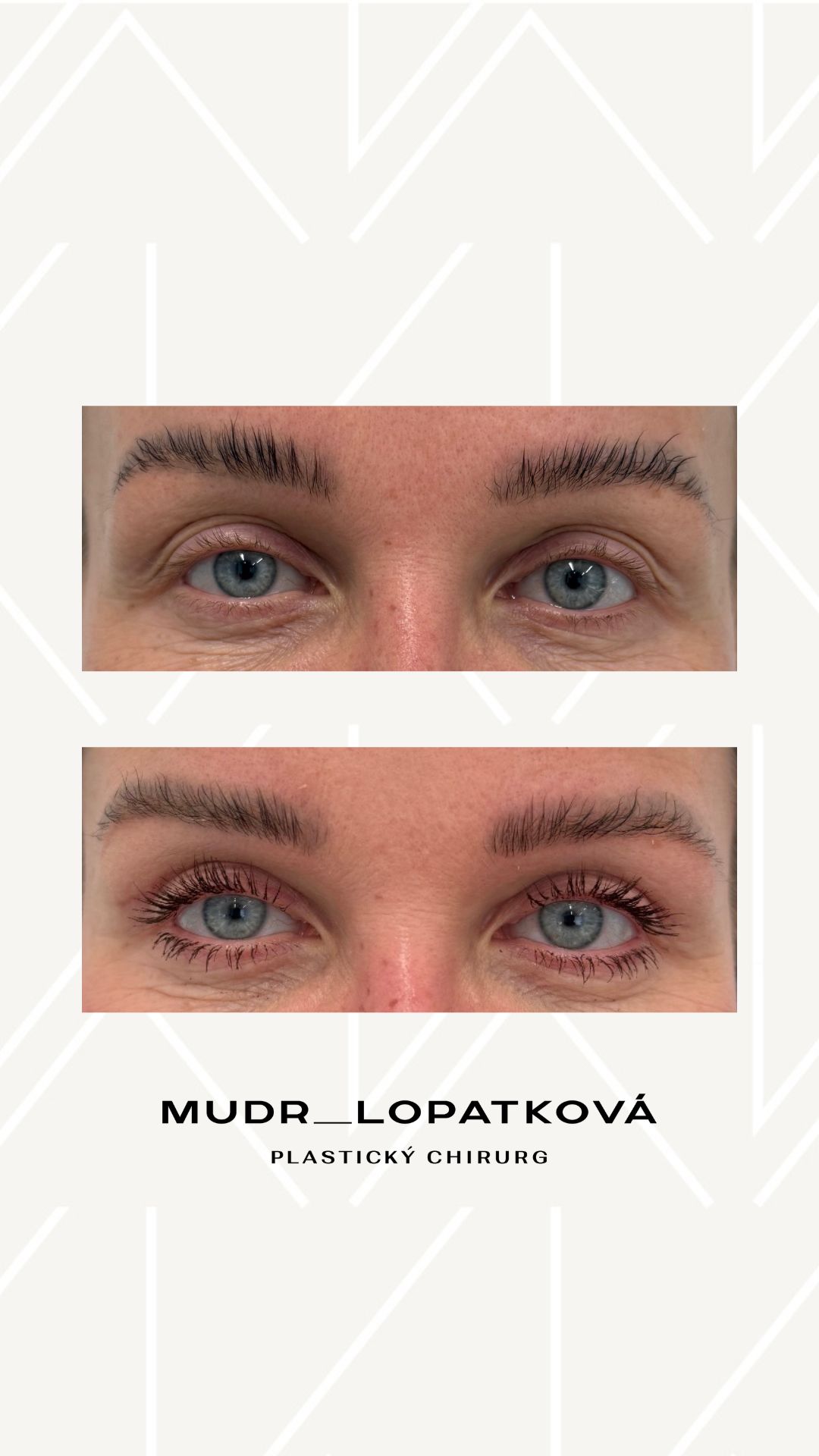 mudrlopatkova - ilustračná fotka časti tela